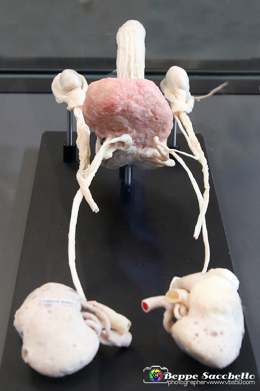 VBS_2562 - Prostata ingrossata - Mostra Body Worlds.jpg